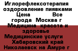 Иглорефлексотерапия, оздоровление пиявками › Цена ­ 3 000 - Все города, Москва г. Медицина, красота и здоровье » Медицинские услуги   . Хабаровский край,Николаевск-на-Амуре г.